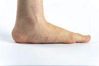 Stretches That Can Help Flat Feet